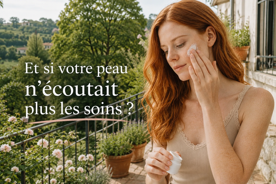 Femme rousse appliquant un soin du visage sur une terrasse méditerranéenne lumineuse, illustrant une peau qui ne réagit plus aux soins contre l’acné adulte