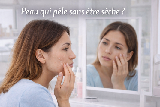 Femme observant une zone de peau qui pèle sur le visage devant un miroir en lumière naturelle douce