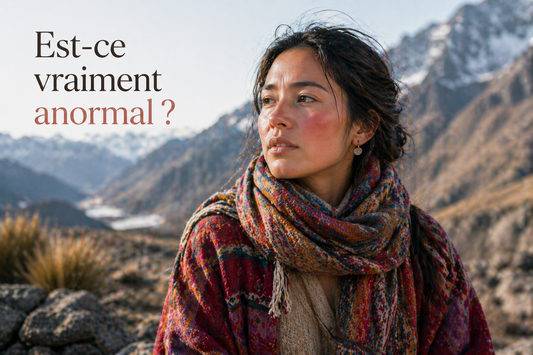 Est-ce normal d’avoir des rougeurs au visage quand je suis dehors ?