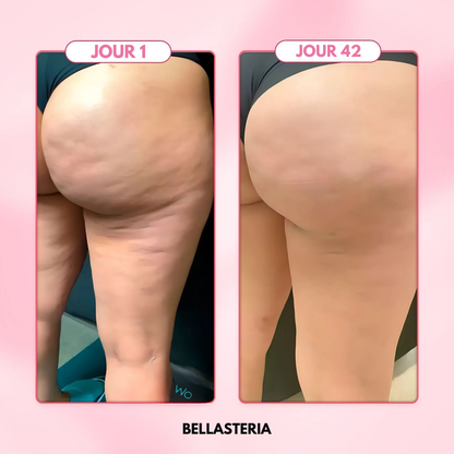 Masseur électrique à ventouses - Bella Cellulite Drainer
