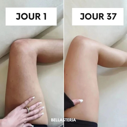 Masseur électrique à ventouses - Bella Cellulite Drainer
