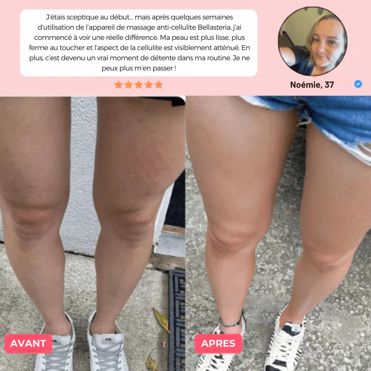 Masseur électrique à ventouses - Bella Cellulite Drainer