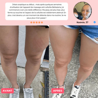 Masseur électrique à ventouses - Bella Cellulite Drainer